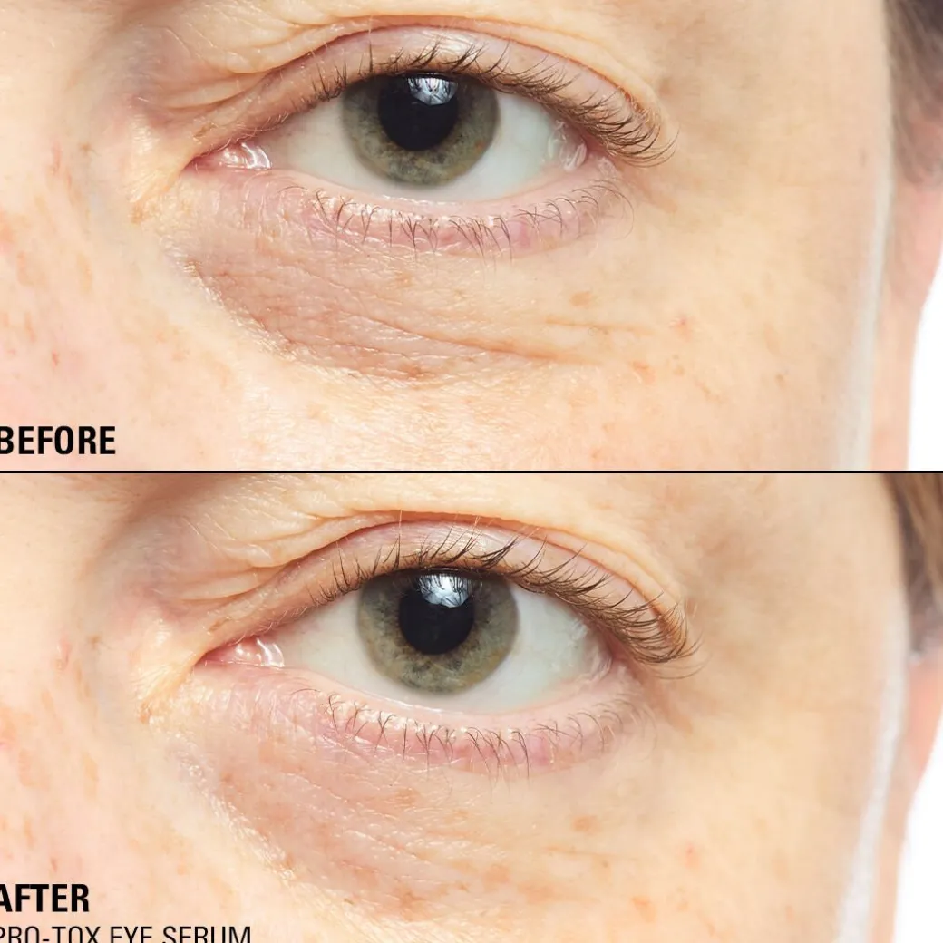Revolution Pro Miracle Pro-Tox Instant Fix Eye Firm