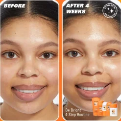 Revolution Skin Brighten Up 3% Vitamin C Brightening Serum 30ml