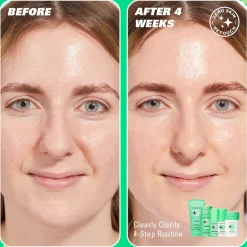 Revolution Skin Clearly Me 2% Salicylic Acid Clarifying Cleansing Gel 150ml